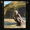 "A mutilated victim of Wemba savagery, Livingstonia", ca.1910 (imp-cswc-GB-237-CSWC47-LS4-1-020).jpg